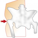 HIPS� H�ftschutz �Kombi� (Hose)